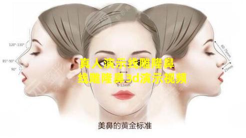 真人演示线雕隆鼻 线雕隆鼻3d演示视频